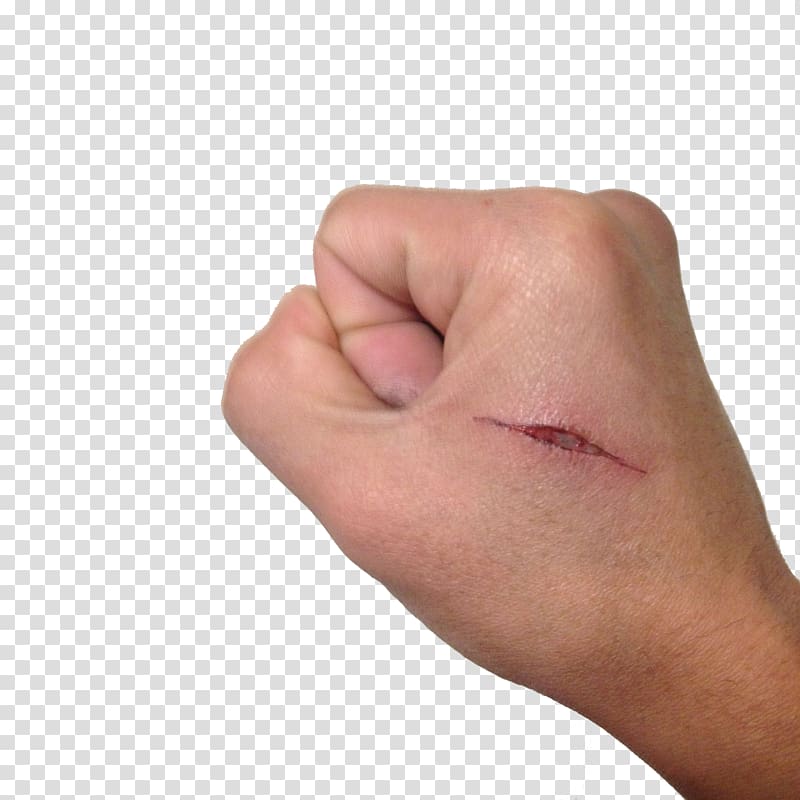 Hand Thumb Scar, The hands of the knife marks transparent background PNG clipart