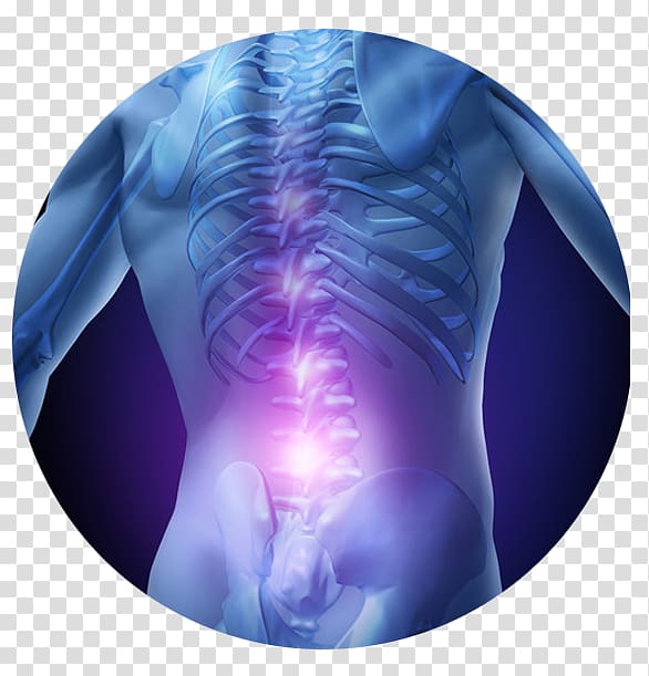 Low back pain Pain management Therapy Spinal disc herniation, pain transparent background PNG clipart