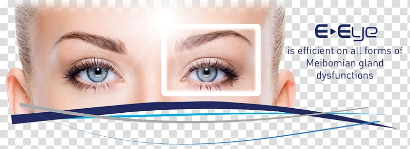 Blepharoplasty Eyelid Surgery Dry eye syndrome Face, Face transparent background PNG clipart