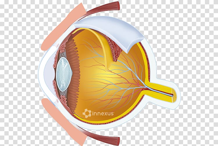 Glaucoma Human eye Retina Eye care professional, Eye Care transparent background PNG clipart