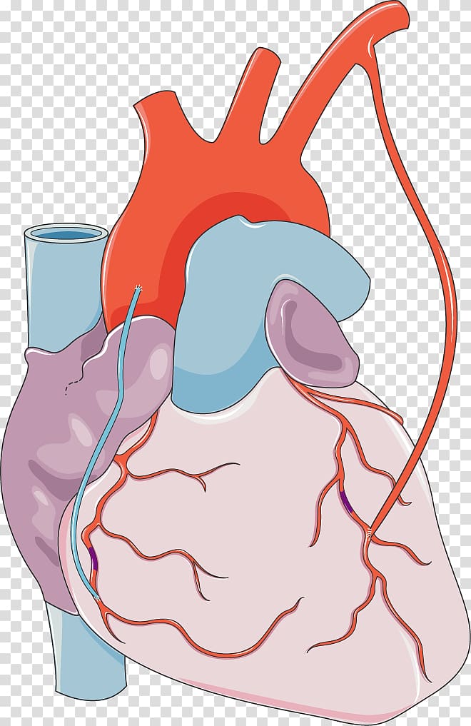 Myocardial infarction Heart Coronary artery disease Blood, the anatomy of a body medicine transparent background PNG clipart
