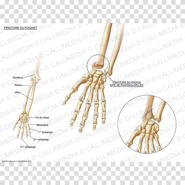 Bone fracture Carpal bones Wrist Pisiform bone, Skeleton transparent background PNG clipart