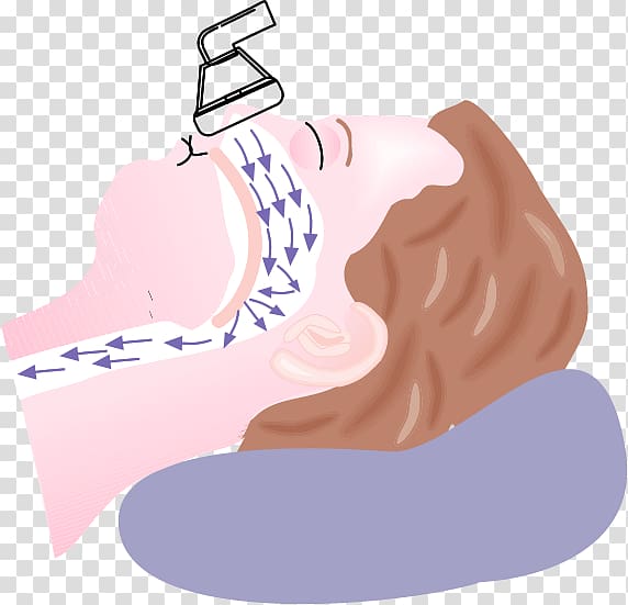 Continuous positive airway pressure Obstructive sleep apnea Therapy, nose transparent background PNG clipart