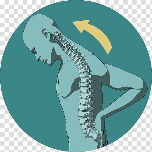 Back pain Pain management Chronic pain Stimulation Therapy, chronic depression transparent background PNG clipart