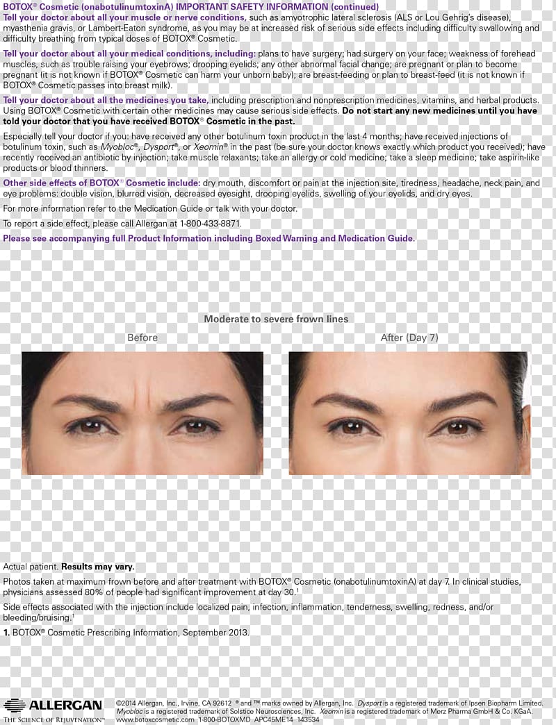 Botulinum toxin Injection Wrinkle Surgery, Aesthetics transparent background PNG clipart