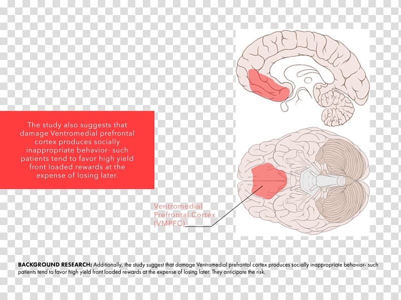 Ventromedial prefrontal cortex Diagram Somatic marker hypothesis Chart, Brain transparent background PNG clipart