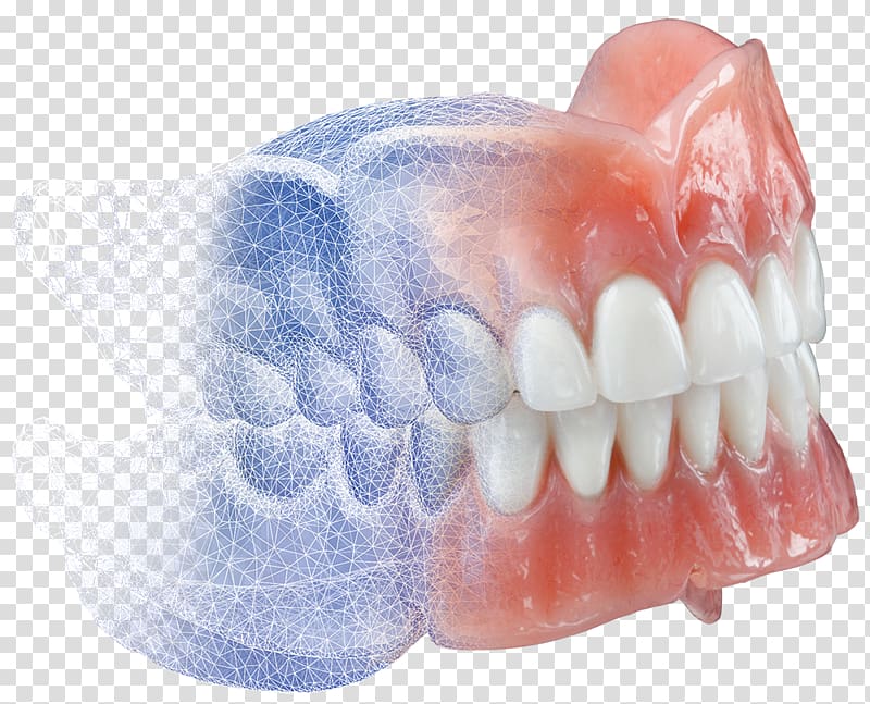 Dentures Burdette Dental Lab CAD/CAM dentistry, 3d dental treatment for toothache transparent background PNG clipart