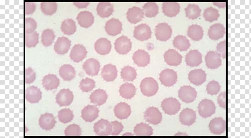 Crenated Red Blood Cells Light Microscope