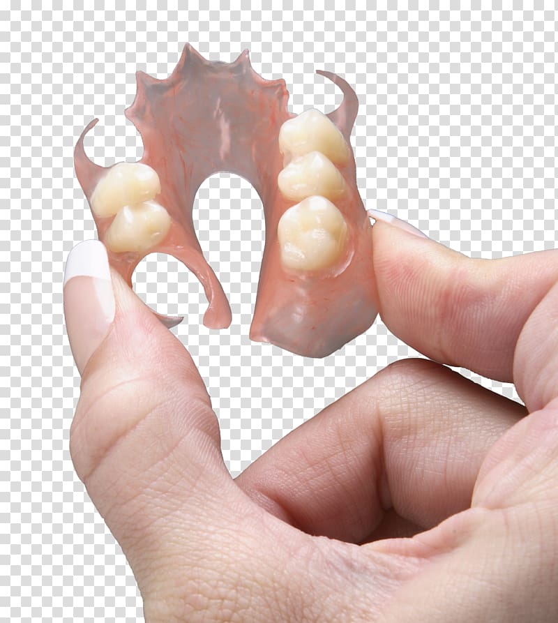 Dentures Dental laboratory Dentistry Removable partial denture, Dental Laboratory transparent background PNG clipart
