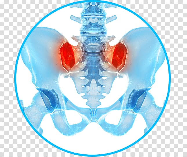 Sacroiliac joint dysfunction Pain in spine Pain management Pelvis, joint pain transparent background PNG clipart