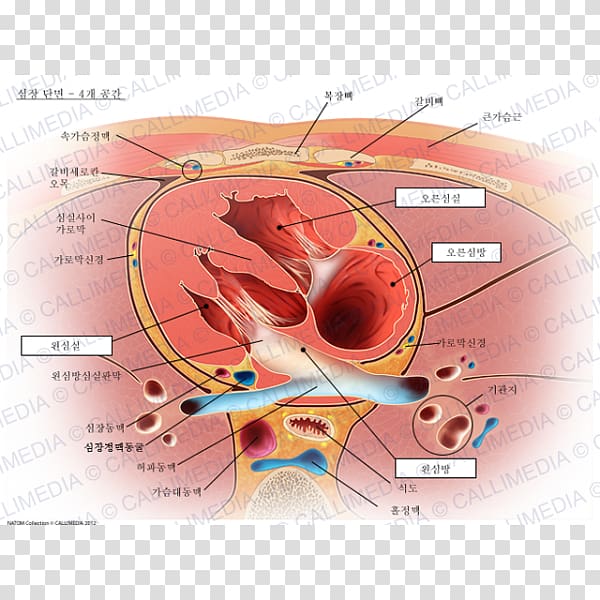 Heart valve Atrium Left ventricle Mitral insufficiency, heart transparent background PNG clipart