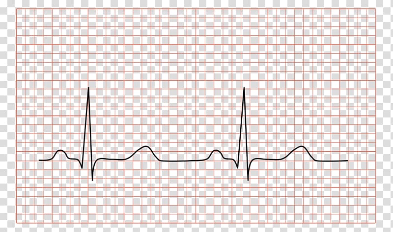Electrocardiography Heart QRS complex Sinus rhythm Sinoatrial node, strips transparent background PNG clipart