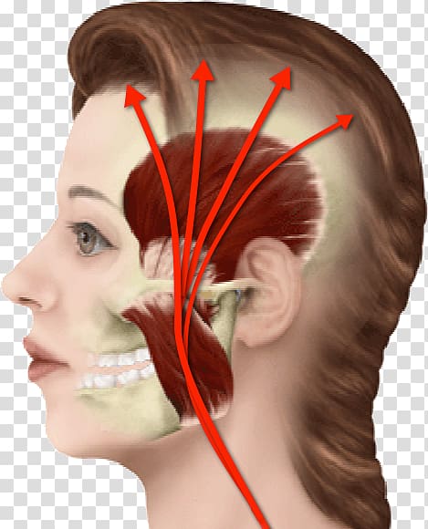 Myofascial pain syndrome Neck pain Orofacial pain Headache Face, Neck Pain transparent background PNG clipart