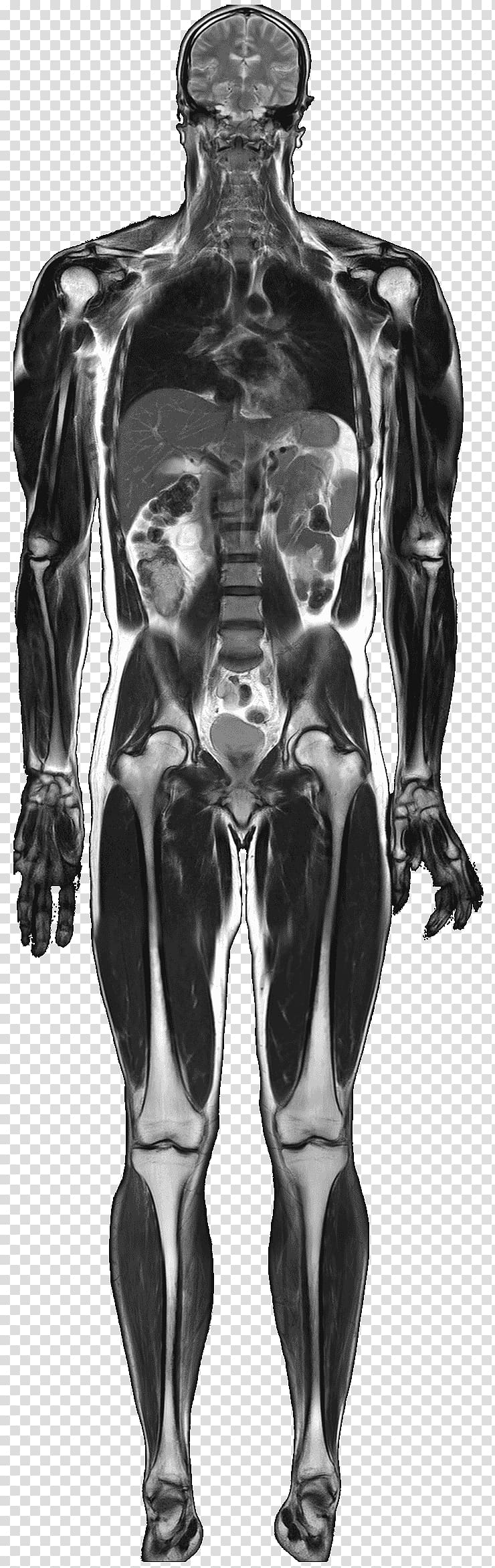 Magnetic resonance imaging Medical imaging Anatomy Human body Nuclear magnetic resonance, standard body transparent background PNG clipart