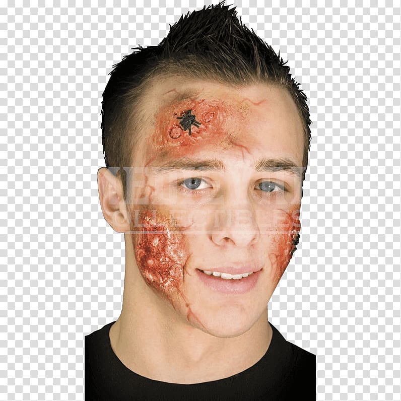 Wound Prosthesis Scar Injury Burn, Wound transparent background PNG clipart