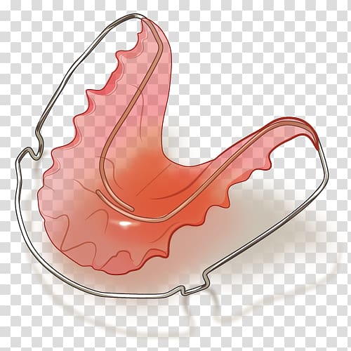 Dental braces Dentistry 矯正歯科 Dentition, retainer transparent background PNG clipart