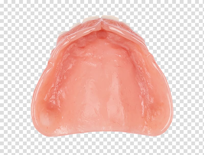 Dentures Dentistry Aspen Dental Lip The Heat, Aspen Dental transparent background PNG clipart