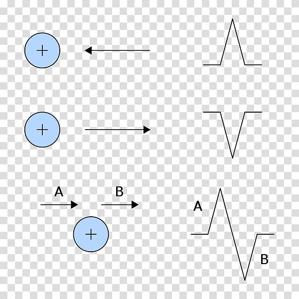 Electrocardiography Electrode Heart Einthoven\'s triangle, source file transparent background PNG clipart