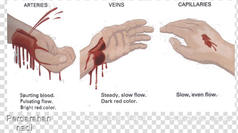 Bleeding Blood Circulatory system Thumb Heart, blood transparent background PNG clipart