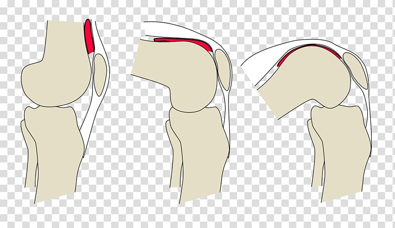 Articular capsule of the knee joint Synovial joint Joint capsule, arthritis transparent background PNG clipart