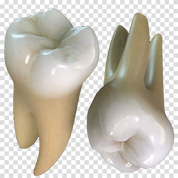 Human tooth Maxillary first molar Tooth decay, crown transparent background PNG clipart
