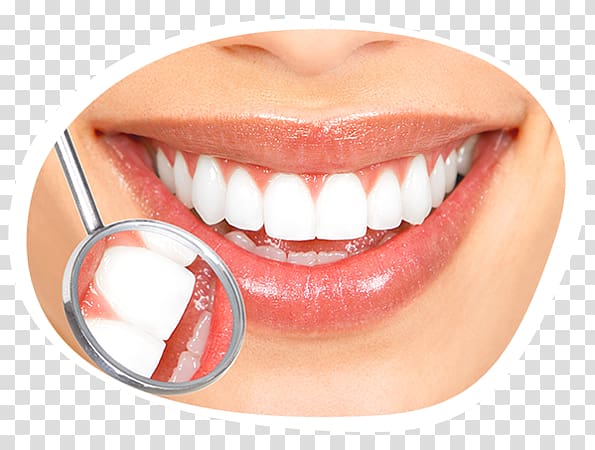Tooth whitening Cosmetic dentistry Human tooth, smile transparent background PNG clipart