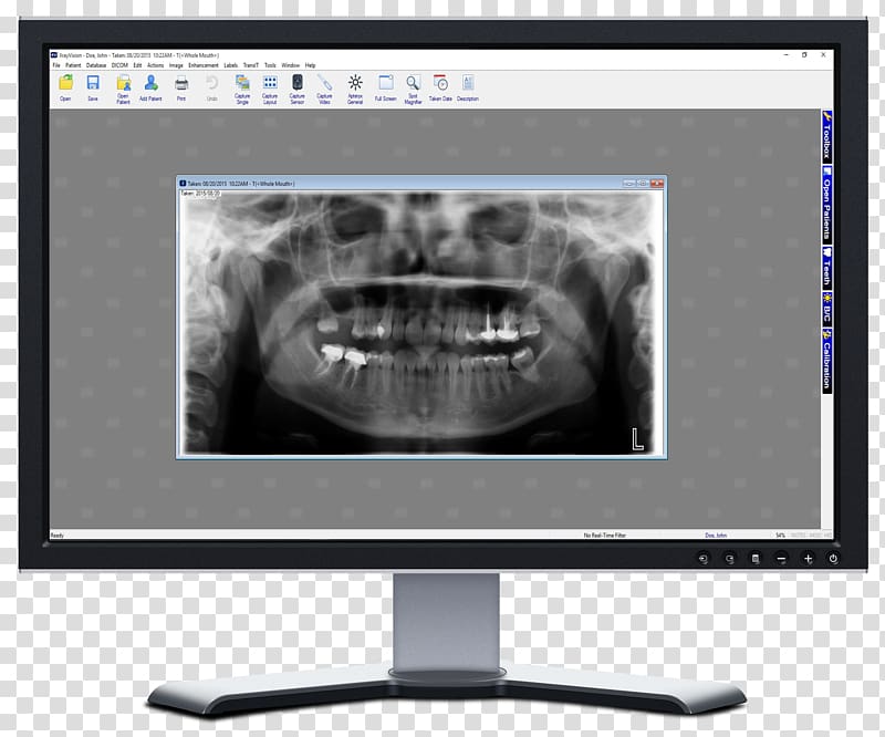 X-ray vision Dental radiography Dentistry, x-ray transparent background PNG clipart