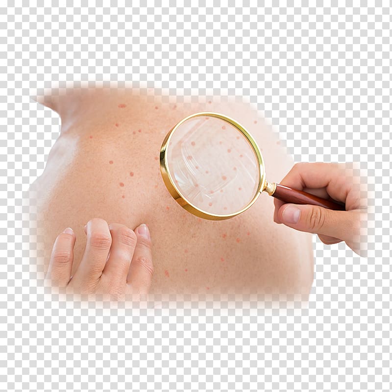 Dermatology Skin cancer Medicine Disease, skin problems transparent background PNG clipart