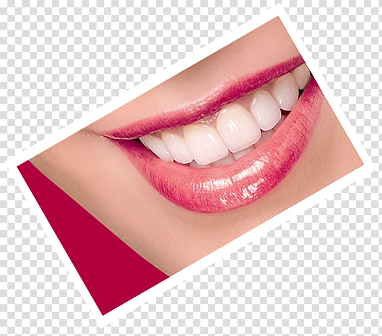 Tooth Dentistry Dental prosthesis American Dental Association, Dental Laboratory transparent background PNG clipart