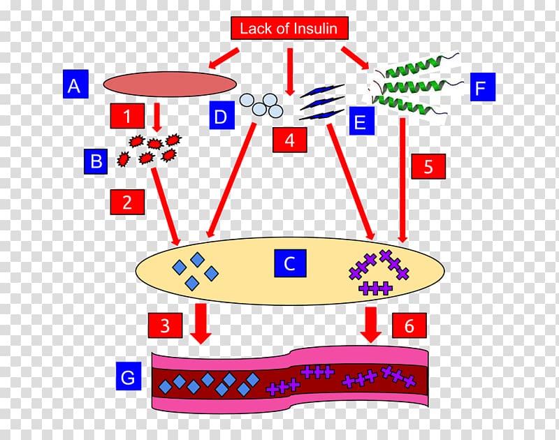 Diabetic ketoacidosis Diabetes mellitus Ketone bodies, blood transparent background PNG clipart