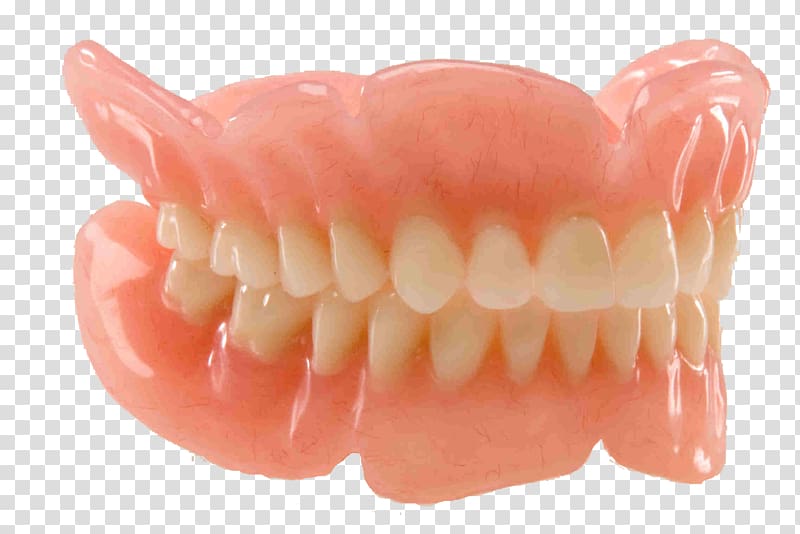 Dentures Dentistry Removable partial denture Dental restoration, teeth model transparent background PNG clipart