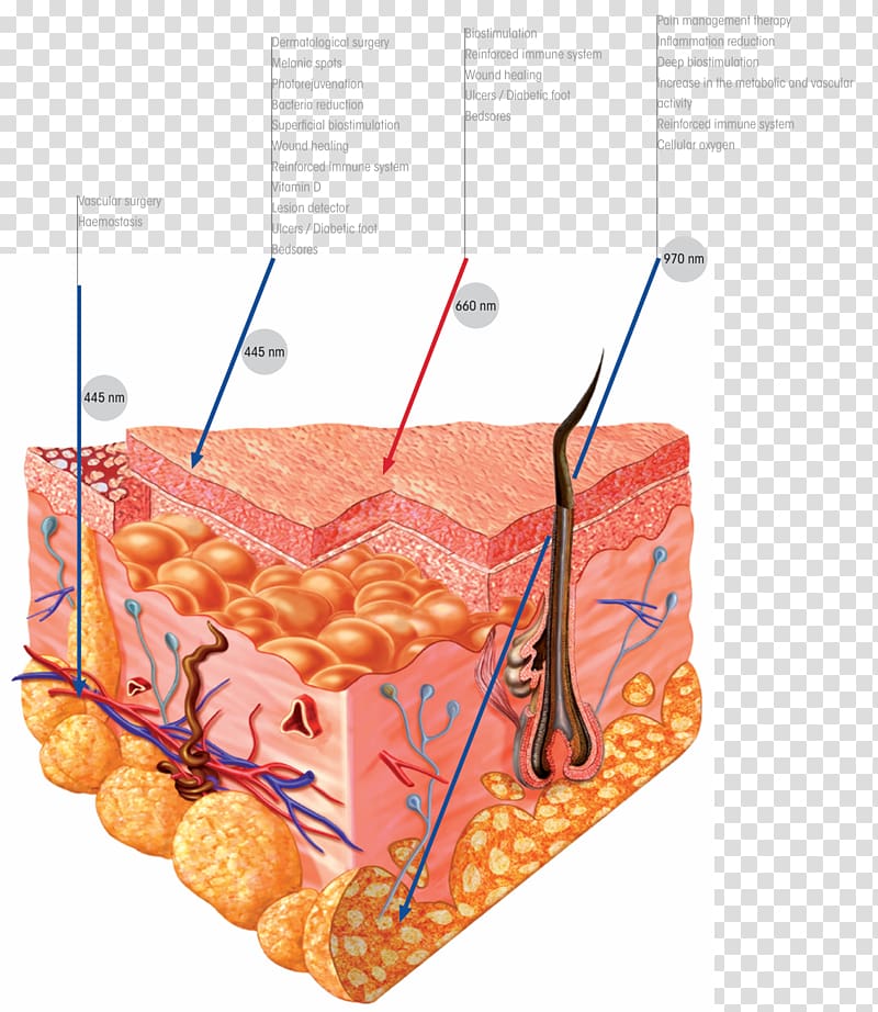 Atopic dermatitis Medicine Light therapy Atopy, Derma Sciences transparent background PNG clipart