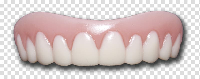 pink and white denture, Veneer Tooth whitening Dentures Tooth pathology, Teeth transparent background PNG clipart