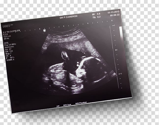 Brand, sonography transparent background PNG clipart