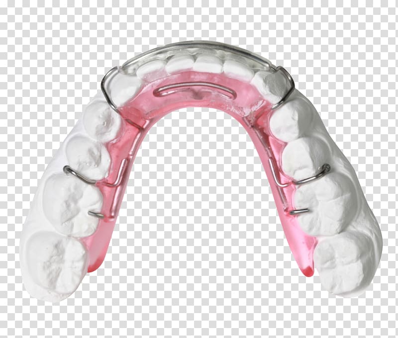 Clear aligners Orthodontics Orthodontic technology Jaw Bionator, others transparent background PNG clipart