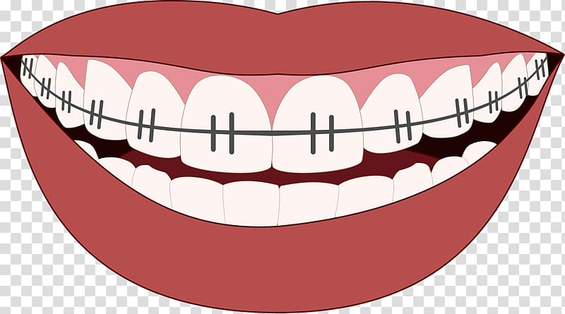 Cosmetic dentistry Orthodontics Dental implant, Orthodontist transparent background PNG clipart