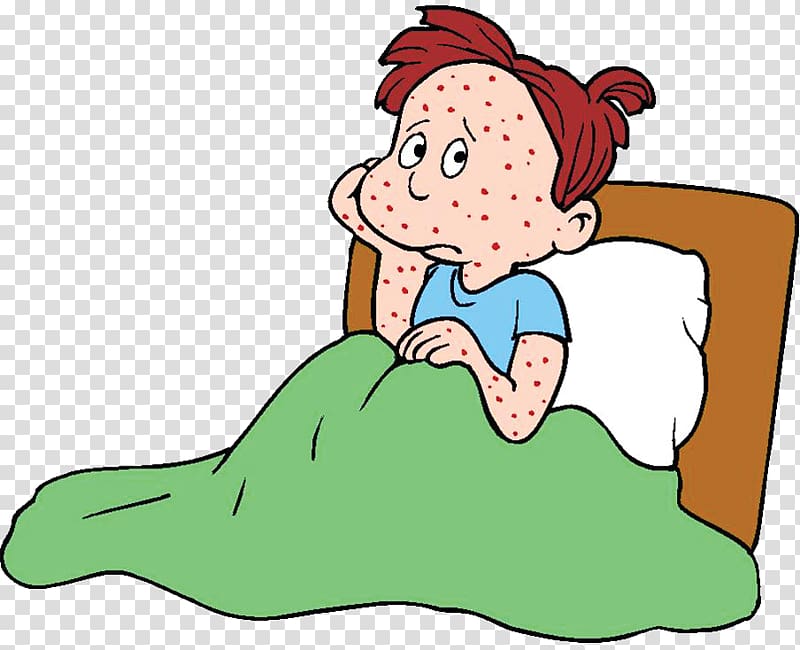 Chickenpox Infection Infectious disease , chicken pox transparent background PNG clipart
