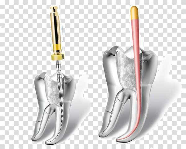 Endodontic therapy Endodontics Root canal Dentistry, health transparent background PNG clipart