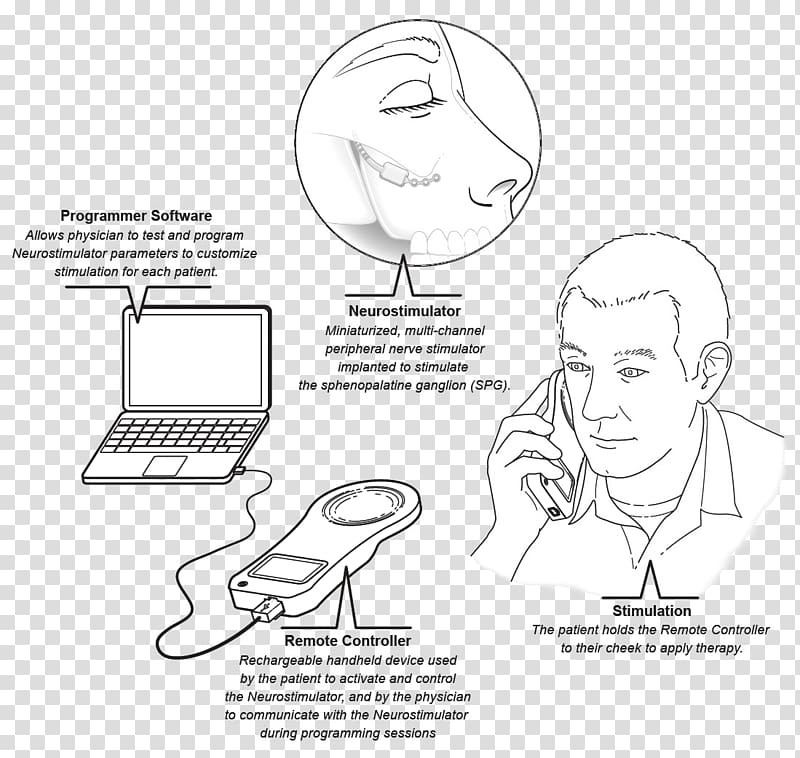 Sketch Ear Illustration Product design, cluster headache symptoms and stages transparent background PNG clipart