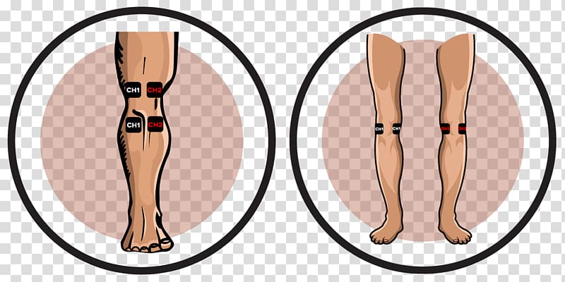 Transcutaneous electrical nerve stimulation Knee pain Electrode Electrical muscle stimulation, irregular counter placement transparent background PNG clipart