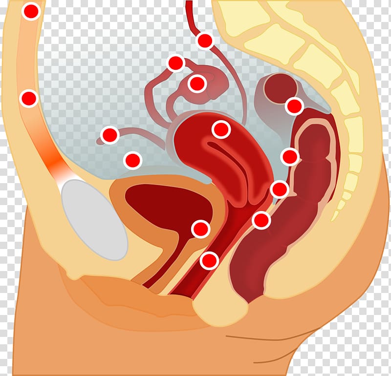 Endometriosis Endometrium Pelvic pain Uterus Disease, internal organs transparent background PNG clipart