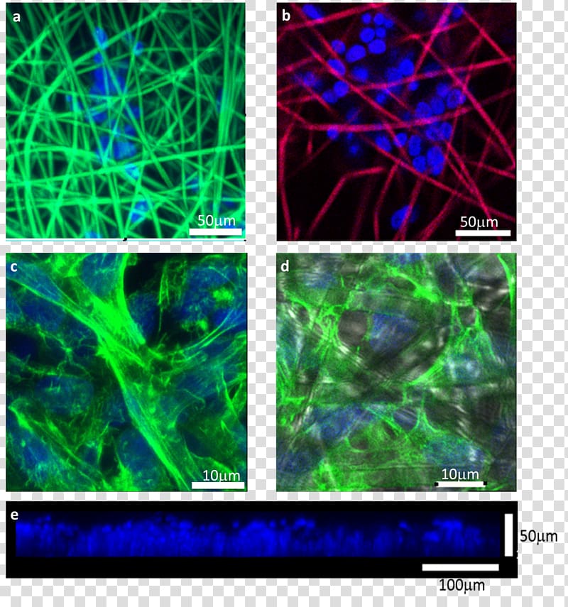 Electrospinning 3D cell culture Staining Confocal microscopy, microscopic cancer cell cartoon transparent background PNG clipart