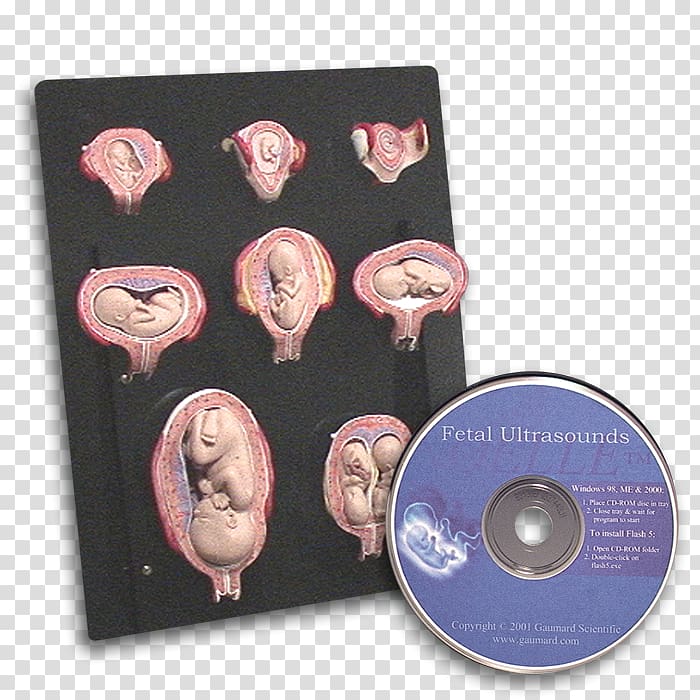 Intra-uterine Development Uterus Childbirth Infant Postpartum period, hand painted duck transparent background PNG clipart