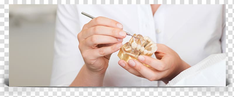 Dentistry Dental implant Dr. Robert C. Dost & Associates Pamela L. Hunte, D.D.S., dental implants transparent background PNG clipart