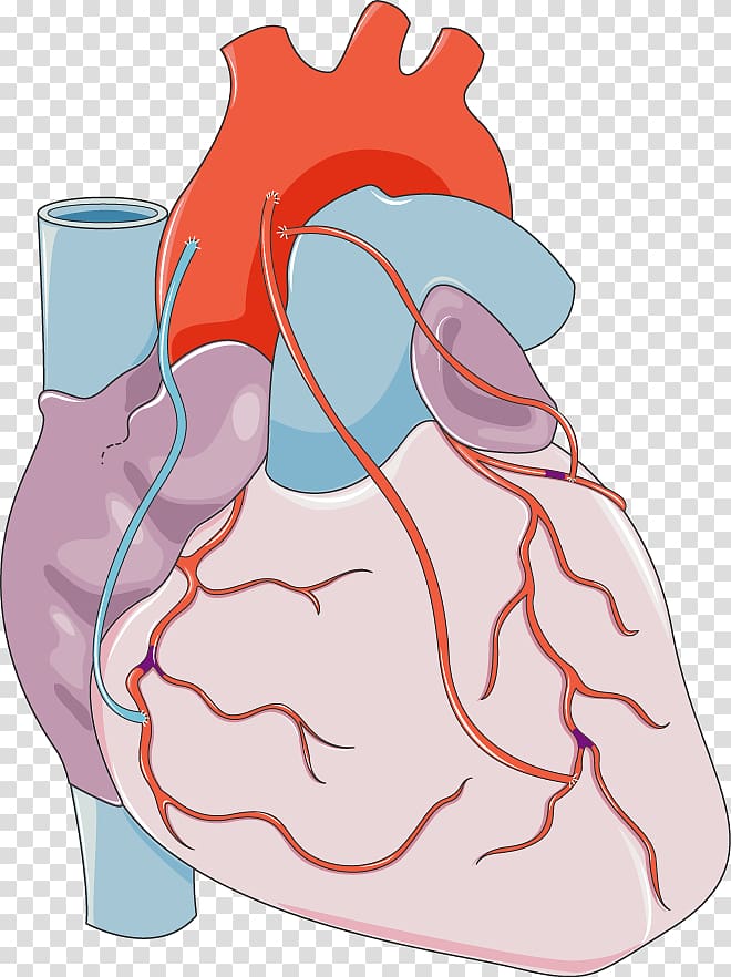 Heart Coronary artery bypass surgery Vascular bypass Coronary arteries, heart transparent background PNG clipart