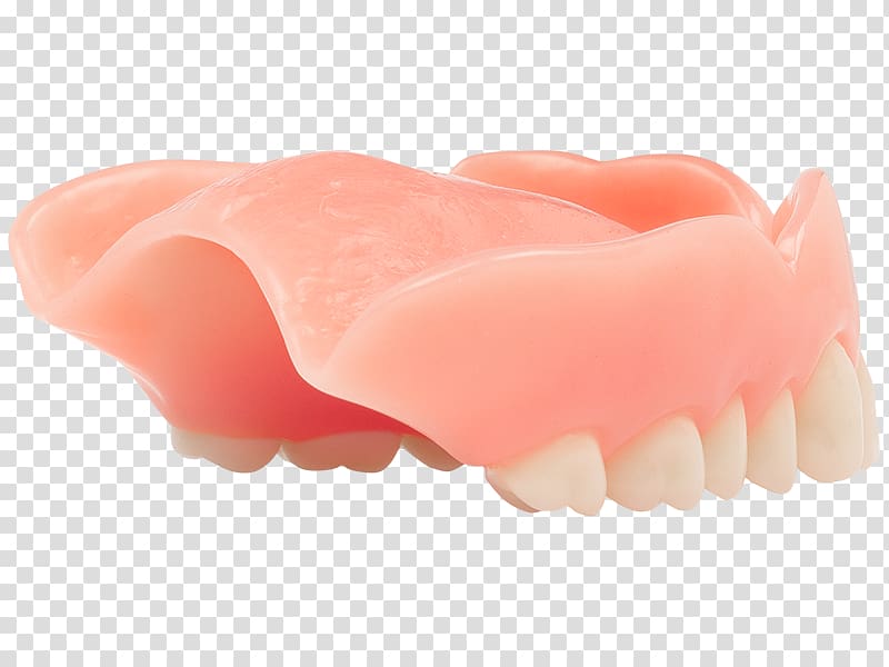 Dentures Jaw Aspen Dental Dentistry, others transparent background PNG clipart