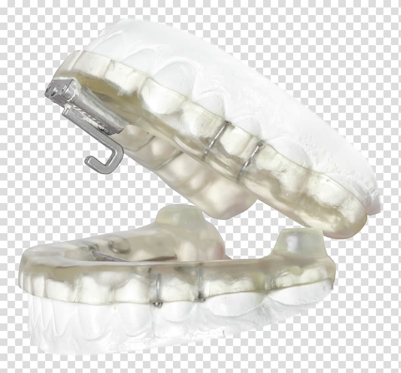 Mandibular advancement splint Obstructive sleep apnea Temporomandibular joint dysfunction, others transparent background PNG clipart