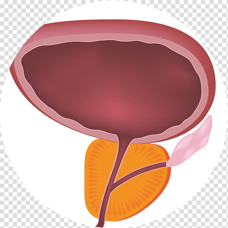 Benign prostatic hyperplasia Prostate Lower urinary tract symptoms Benignity, prostate transparent background PNG clipart