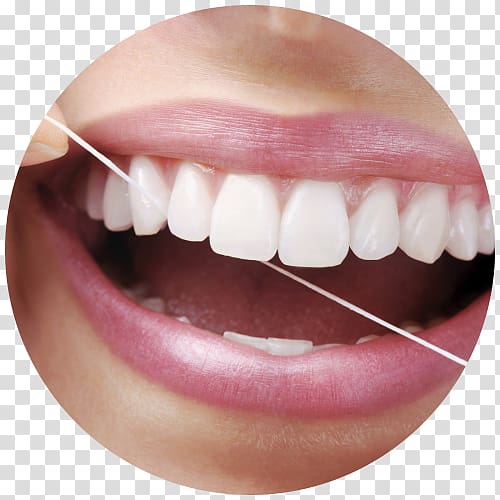 Dental Floss Periodontal disease Dentistry Human tooth, others transparent background PNG clipart