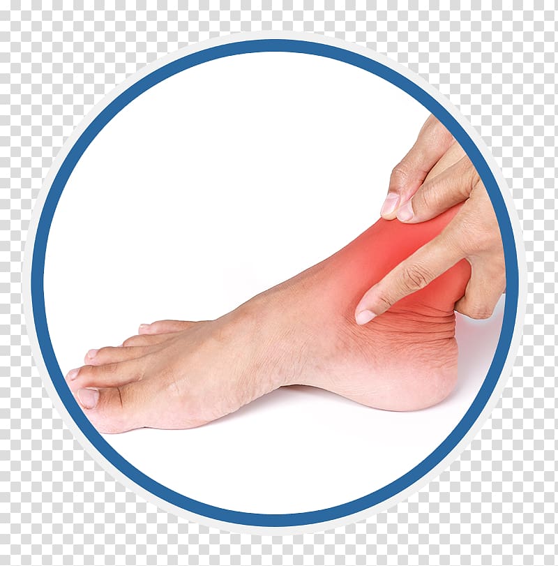 Sprained ankle Pain Injury, others transparent background PNG clipart